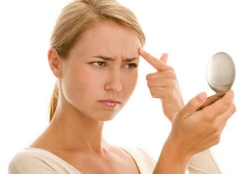 Điều trị sẹo rỗ sau mụn - không còn là cơn ác mộng