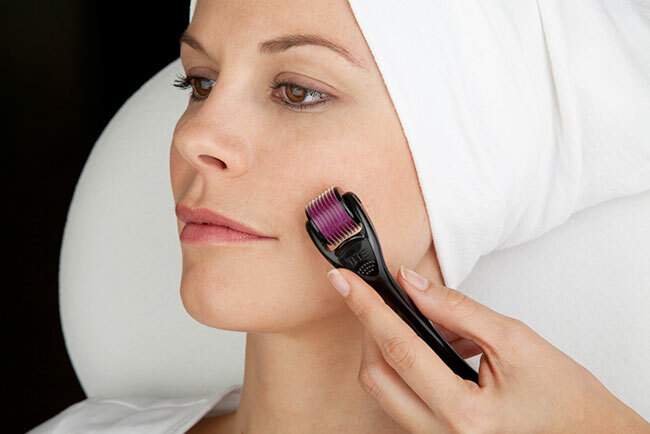 Điều trị sẹo rỗ tại TPHCM không khó như bạn nghĩ