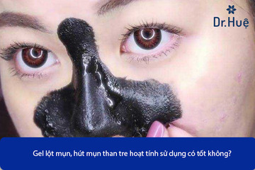 Gel Hút Mụn Lột Mụn Than Tre Hoạt Tính Sử Dụng Có Tốt Không