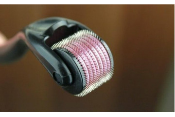 Giá điều trị sẹo lõm bằng kim lăn không quá đắc đỏ như bạn nghĩ