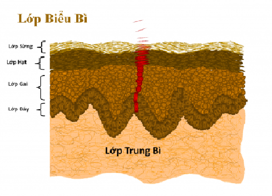 Giá điều trị sẹo lõm bằng kim lăn tại Dr Huệ là bao nhiêu?