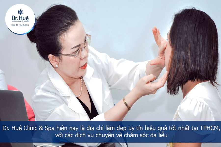 khám chữa mụn tại Dr. Huệ