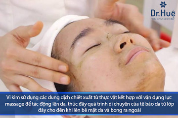 [Giải Đáp] Vi Kim Và Phi Kim Khác Nhau Như Thế Nào?