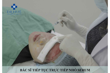 Giải pháp trị sẹo rỗ lâu năm an toàn và hiệu quả