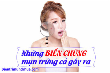 Giật mình với những biến chứng mụn trứng cá gây ra