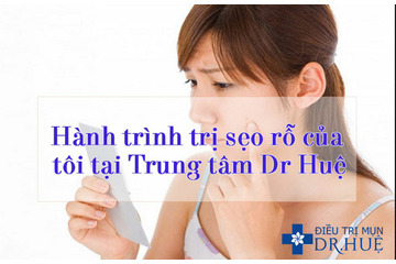 Hành trình trị sẹo rỗ của tôi tại Trung tâm Dr. Huệ