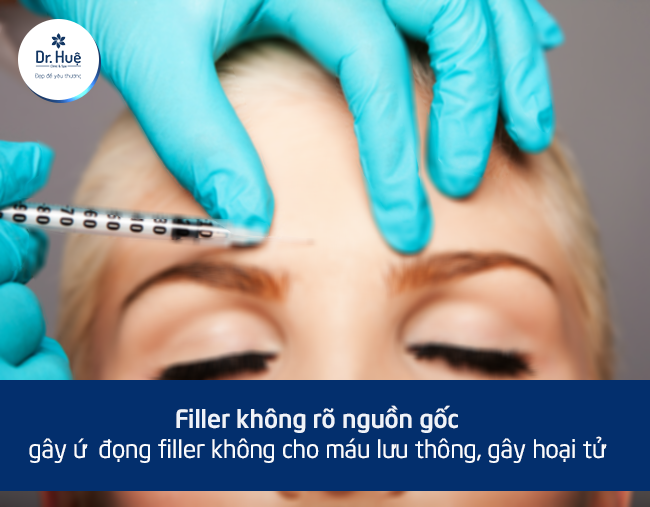 Haaquj quả tiêm filler không rõ nguồn gốc