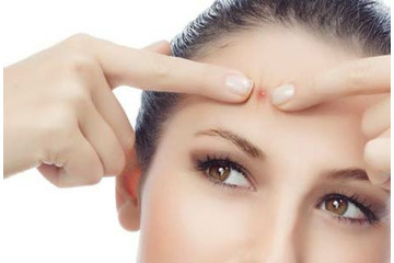 Hãy cẩn thận với những phương pháp trị mụn siêu tốc!