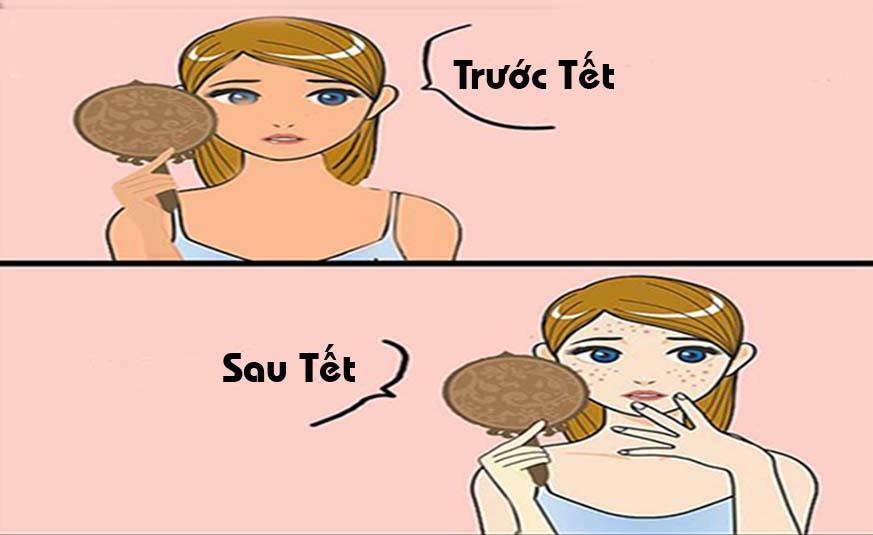 Hết Tết Mụn Lại Ầm Ầm Đến Thăm