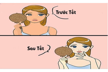 Hết Tết Mụn Lại Ầm Ầm Đến Thăm