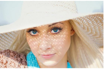 Hiệu quả từ liệu trình điện di sẽ kéo dài bao lâu?