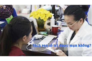 Hỏi đáp cùng Bác sĩ: Tách sẹo có trị mụn được không?