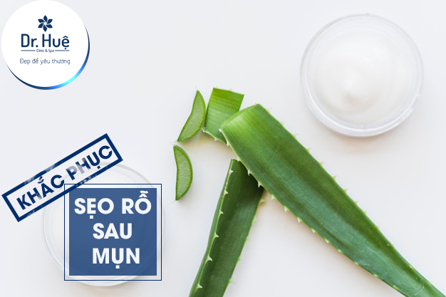 Trị sẹo bằng lô hội