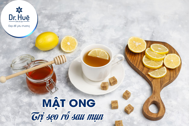 Mật ong trị sẹo rỗ 