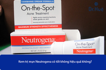 Kem Trị Mụn Neutrogena Có Tốt Không Hiệu Quả Không