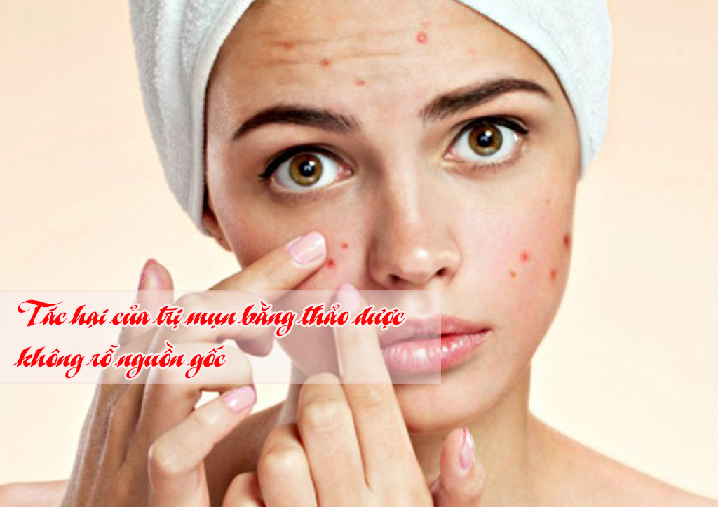 Lại thêm một trường hợp bị biến chứng sau khi trị mụn bằng thảo dược