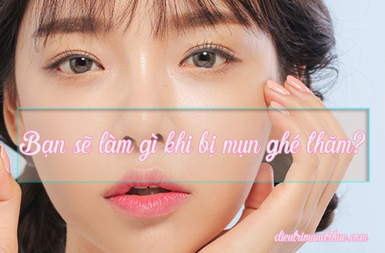 Làm thế nào khi bạn bị mụn ghé thăm