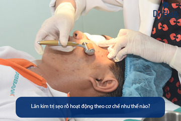 Nano Basic Có Hết Sẹo Rỗ Sẹo Lõm Hay Không