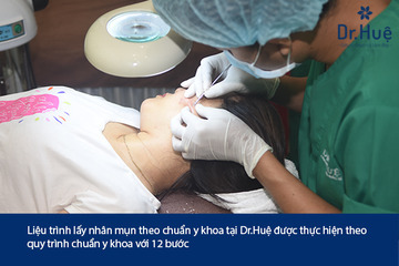 Lấy Nhân Mụn Là Cách Chăm Sóc Da Hiệu Quả Nhất