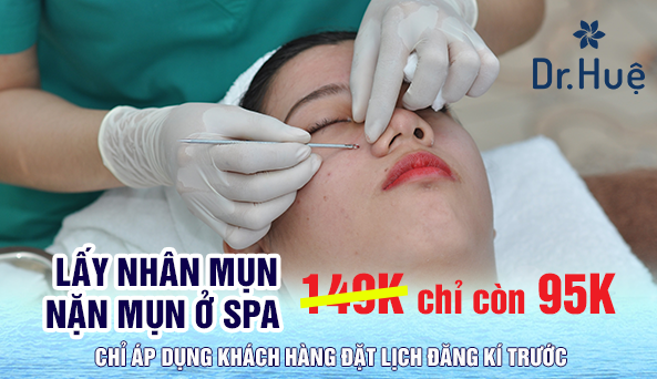 Lấy Nhân Mụn - Nặn Mụn Ở Spa Giá Hết Bao Nhiêu Tiền