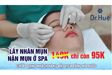 Lấy Nhân Mụn - Nặn Mụn Ở Spa Giá Hết Bao Nhiêu Tiền