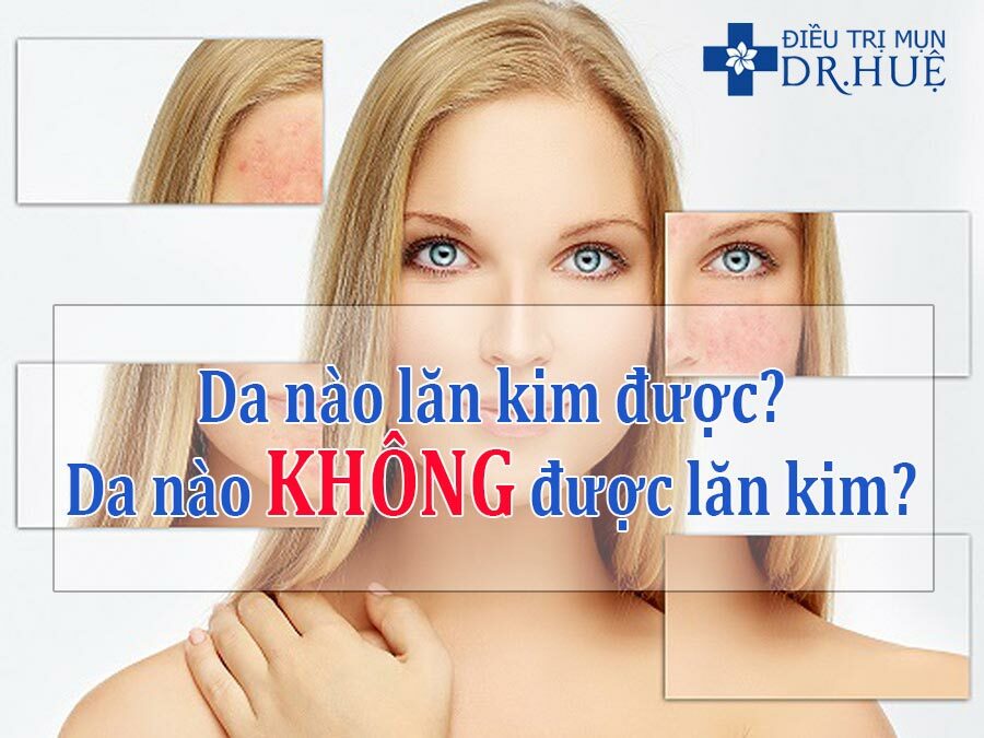 Loại da nào nên và không nên Nano Basic?