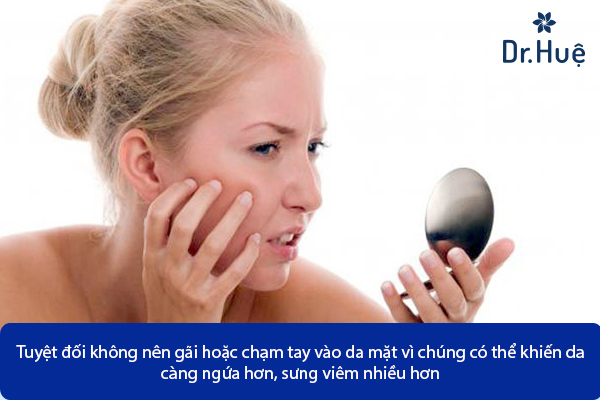 Vì sao Mặt Đột Nhiên Nổi Nhiều Mụn Nhỏ Đỏ Và Ngứa Phải Làm Sao