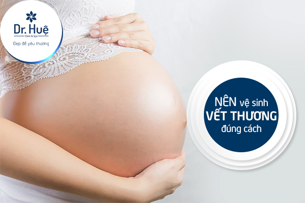 Mẹo trị vết sẹo sau sinh mổ hiệu quả