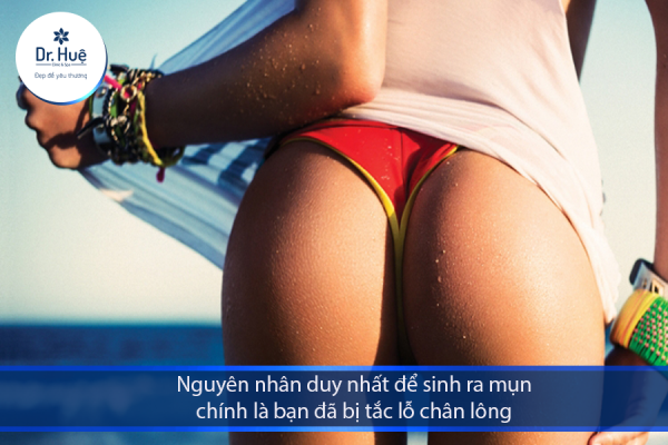 Mọc mụn ở mông là bị sao và cách trị mụn ở mông tốt nhất
