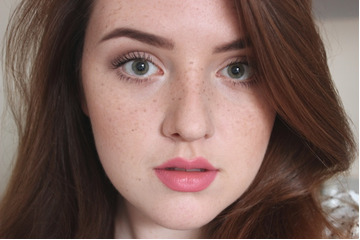 Mụn đầu đen để lâu có trở thành tàn nhang không?