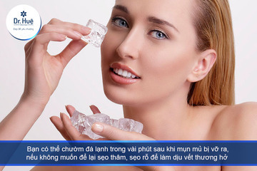 Mụn mủ bị vỡ chảy máu phải làm sao nên làm gì?