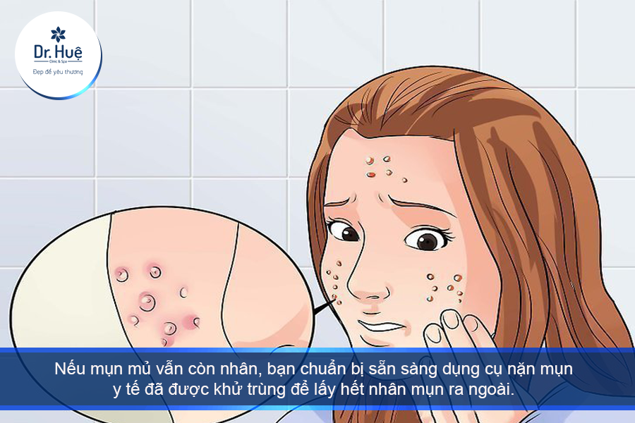 Cách điều trị mụn mủ 