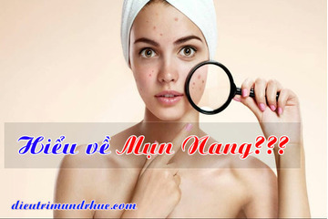 MỤN NANG LÀ GÌ? Dấu hiệu và cách điều trị mụn nang