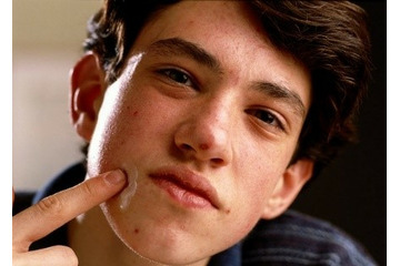 Nam sinh đi trị mụn – Chuyện giờ mới kể