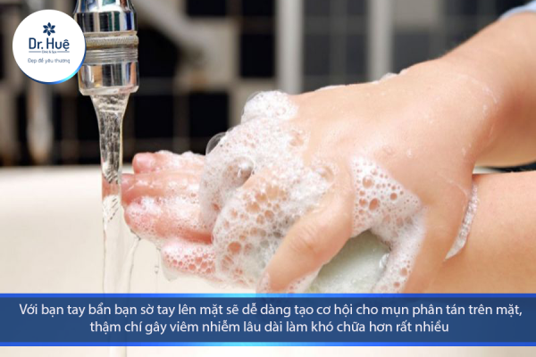 Nặn mụn để lại máu bầm phải làm sao