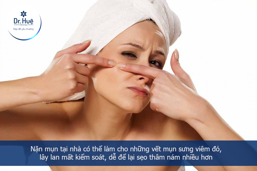 Tác hại nặn mụn tại nhả 