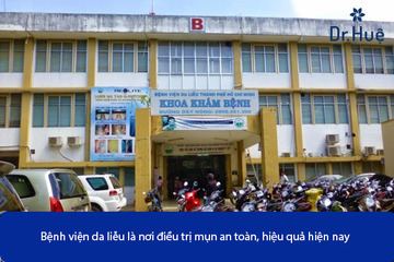 Nên Trị Mụn Ở Da Liễu Hay Thẩm Mỹ Viện Spa