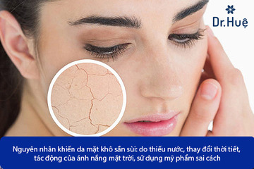 Nguyên Nhân Da Mặt Khô Sần Sùi Và Cách Điều Trị Làm Da Mặt Mịn Màng Hơn