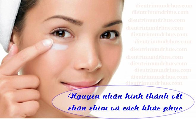 Nguyên nhân hình thành vết chân chim và cách khắc phục