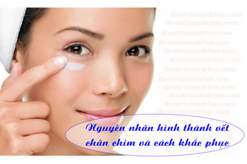 Nguyên nhân hình thành vết chân chim và cách khắc phục