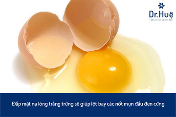 Những Cách Trị Mụn Đầu Đen Bằng Lòng Trắng Trứng Gà Đơn Giản Tại Nhà
