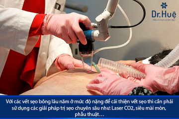Những Cách Trị Sẹo Bỏng Lâu Năm Hiệu Quả Tốt Nhất Tại Dr. Huệ