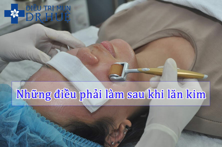 Những điều phải làm sau khi lăn kim