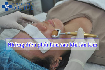 Những điều phải làm sau khi lăn kim