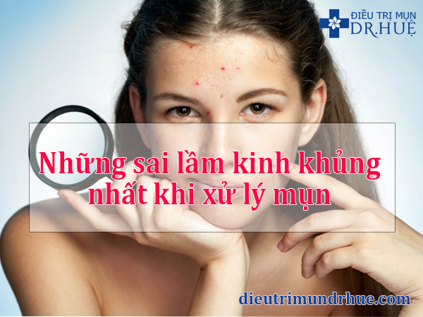 Những sai lầm kinh khủng nhất khi xử lý mụn