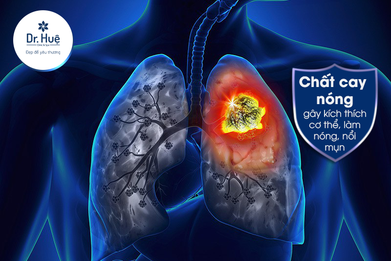 Nóng trong người nổi mụn nên uống gì là tốt nhất?