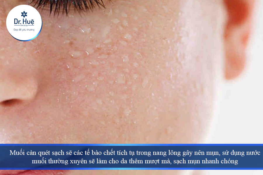 Rữa mặt bằng nước muối sinh lý 