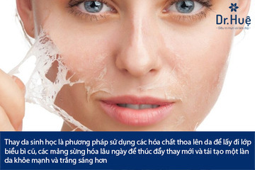 Peed Da Thay Da Sinh Học Trị Mụn Là Gì - Cách Trị Mụn Này Có Tốt Không