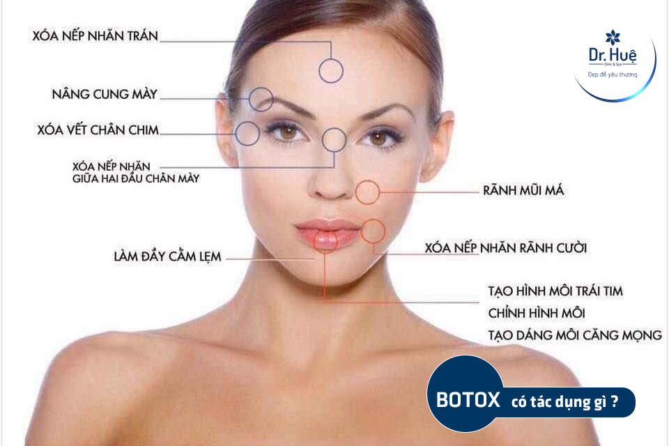 Tiêm botox có tác dụng gì ?