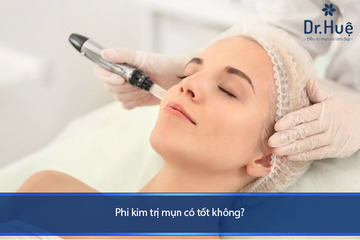 Phi Kim Là Gì - Phi Kim Trị Mụn Có Hiệu Qủa Không, Có Nên Sử Dụng Phương Pháp Này Không?